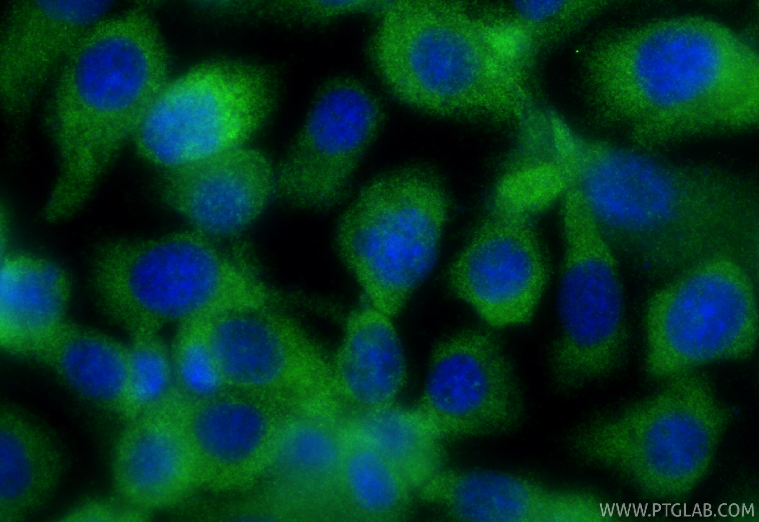 Immunofluorescence (IF) / fluorescent staining of PC-3 cells using OTUD6B Polyclonal antibody (25430-1-AP)