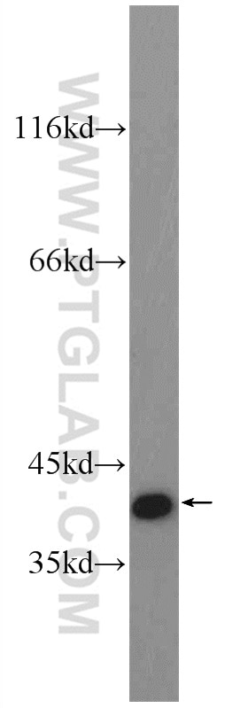 Western Blot (WB) analysis of MCF-7 cells using OTUD6B Polyclonal antibody (25430-1-AP)