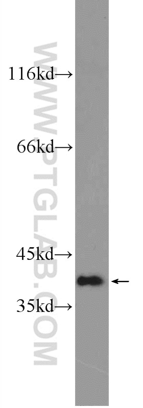 Western Blot (WB) analysis of Jurkat cells using OTUD6B Polyclonal antibody (25430-1-AP)