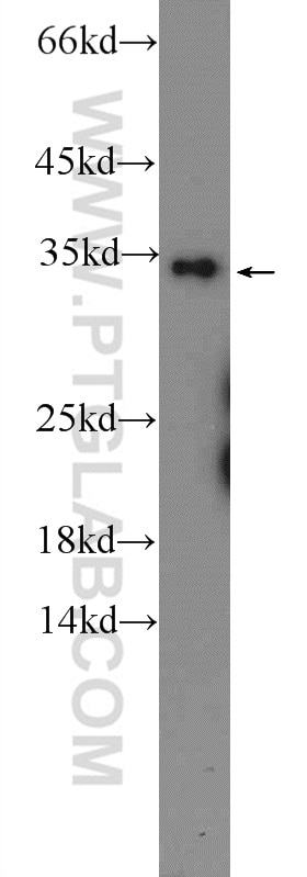 Western Blot (WB) analysis of HEK-293 cells using OTUD6B Polyclonal antibody (25430-1-AP)