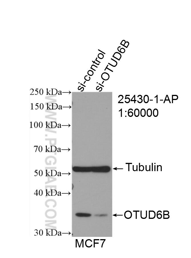 Western Blot (WB) analysis of HeLa cells using OTUD6B Polyclonal antibody (25430-1-AP)