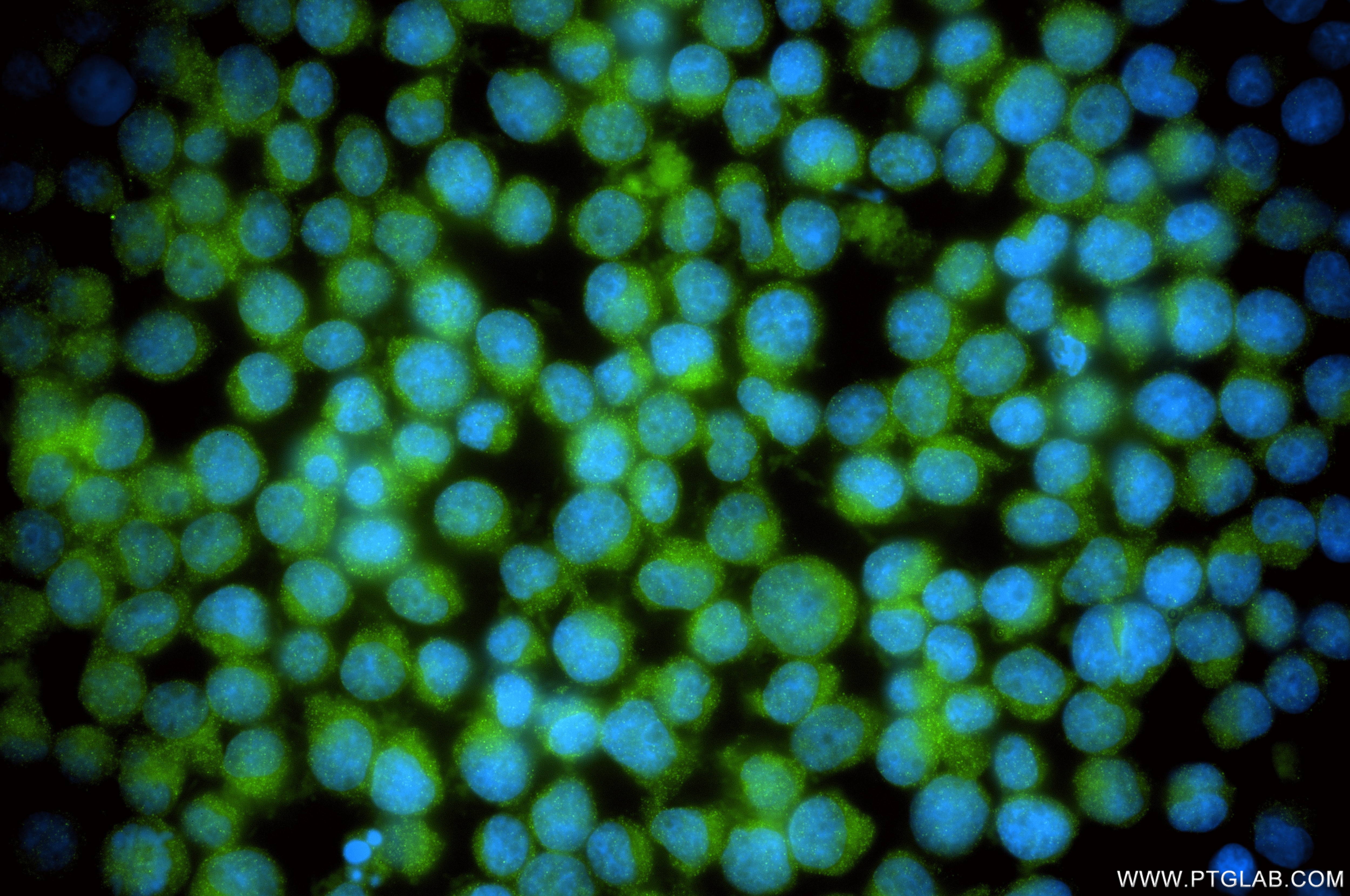 Immunofluorescence (IF) / fluorescent staining of Jurkat cells using OTUD6B Recombinant monoclonal antibody (87049-1-RR)