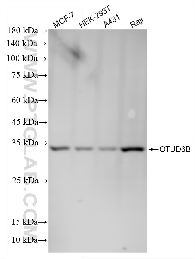 Western Blot (WB) analysis of various lysates using OTUD6B Recombinant monoclonal antibody (87049-1-RR)