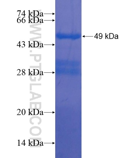 OTUD6B fusion protein Ag22044 SDS-PAGE