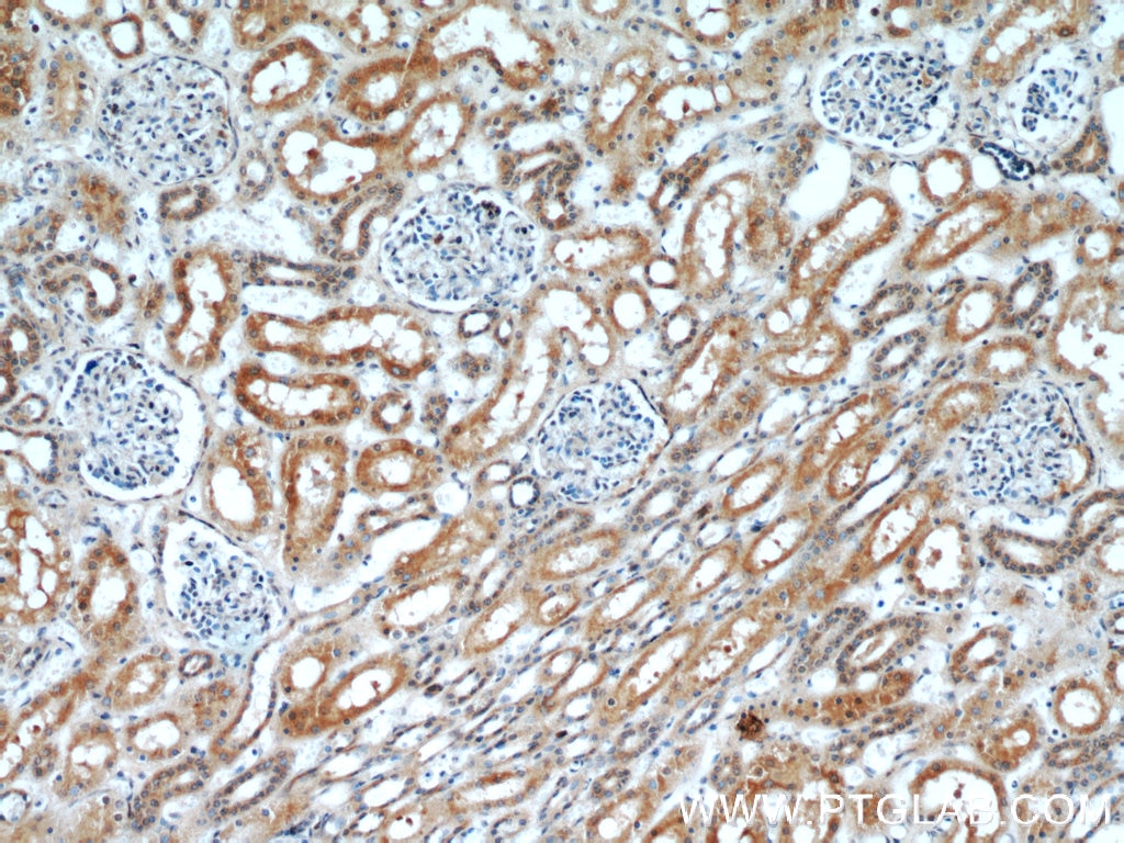 Immunohistochemistry (IHC) staining of human kidney tissue using OTUD7B Polyclonal antibody (16605-1-AP)