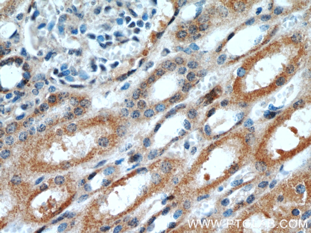 Immunohistochemistry (IHC) staining of human kidney tissue using OTUD7B Polyclonal antibody (16605-1-AP)