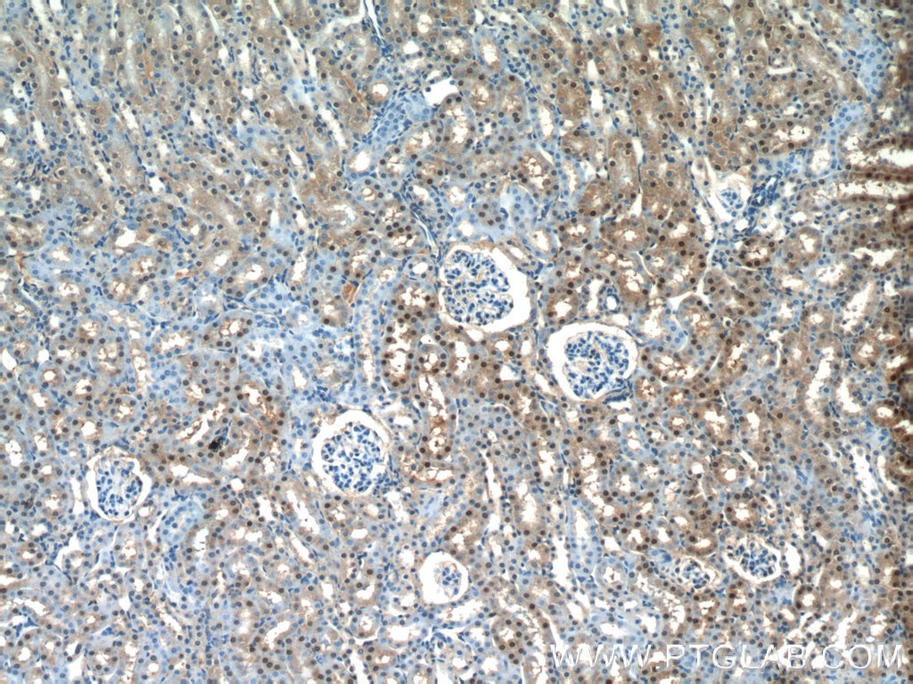 Immunohistochemistry (IHC) staining of mouse kidney tissue using OTUD7B Polyclonal antibody (16605-1-AP)