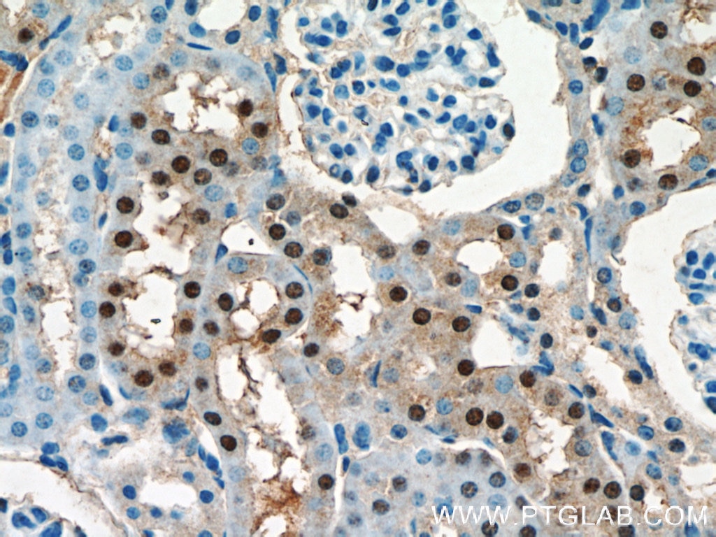 Immunohistochemistry (IHC) staining of mouse kidney tissue using OTUD7B Polyclonal antibody (16605-1-AP)
