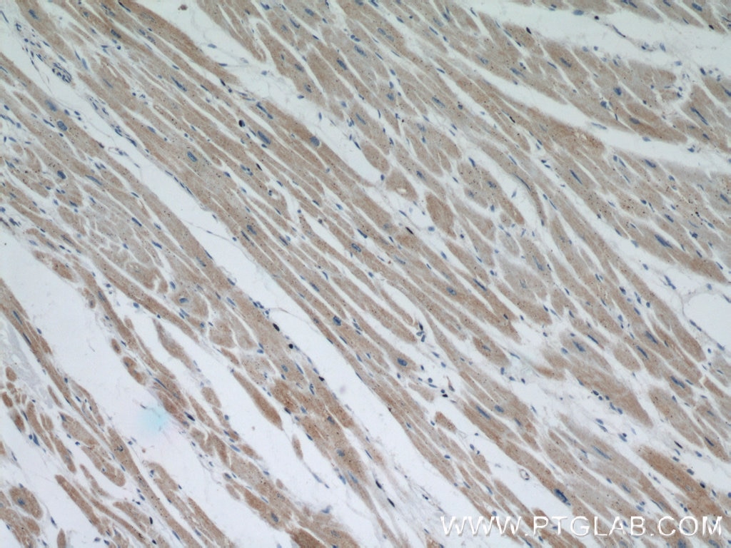 Immunohistochemistry (IHC) staining of human heart tissue using OTUD7B Polyclonal antibody (16605-1-AP)