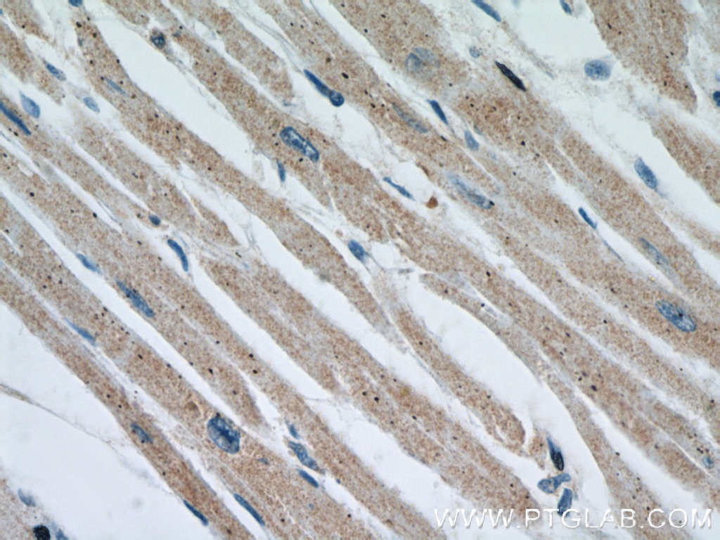 Immunohistochemistry (IHC) staining of human heart tissue using OTUD7B Polyclonal antibody (16605-1-AP)