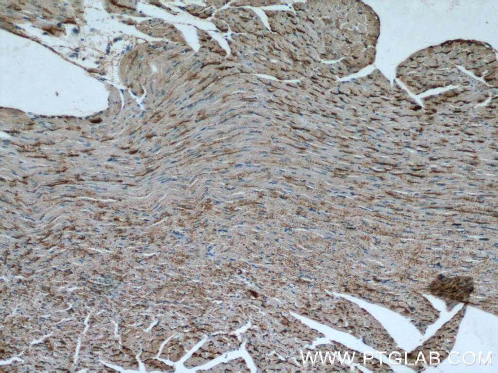 Immunohistochemistry (IHC) staining of mouse heart tissue using OTUD7B Polyclonal antibody (16605-1-AP)