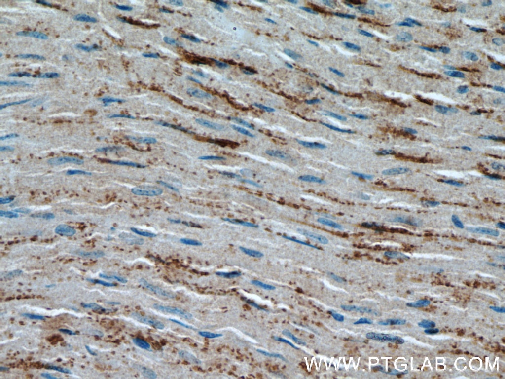 Immunohistochemistry (IHC) staining of mouse heart tissue using OTUD7B Polyclonal antibody (16605-1-AP)