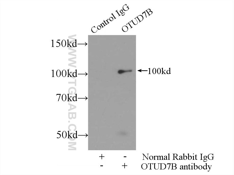 Immunoprecipitation (IP) experiment of Jurkat cells using OTUD7B Polyclonal antibody (16605-1-AP)