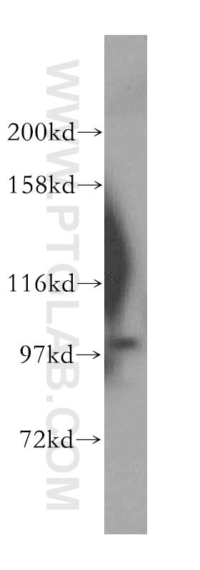 Western Blot (WB) analysis of Jurkat cells using OTUD7B Polyclonal antibody (16605-1-AP)