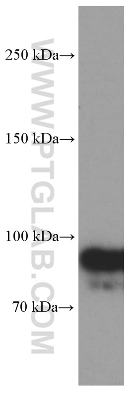 Western Blot (WB) analysis of Jurkat cells using OTUD7B Monoclonal antibody (66276-1-Ig)