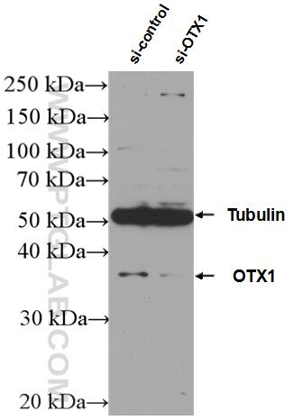 Western Blot (WB) analysis of HEK-293 cells using OTX1 Polyclonal antibody (26595-1-AP)