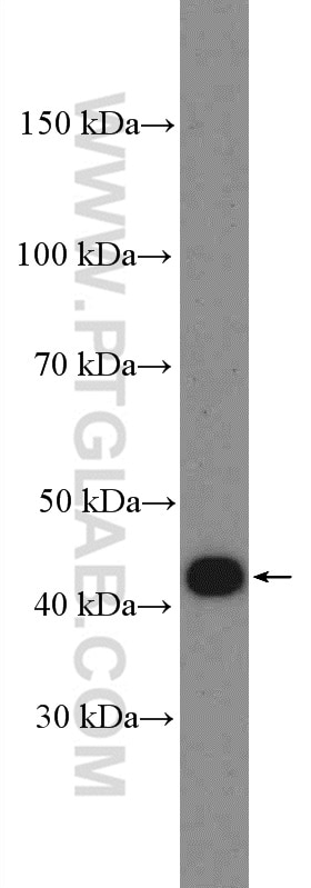 Western Blot (WB) analysis of COLO 320 cells using OTX1 Polyclonal antibody (26595-1-AP)