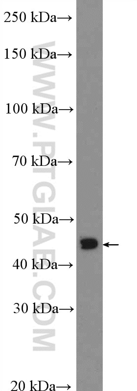 Western Blot (WB) analysis of COLO 320 cells using OTX1 Polyclonal antibody (26595-1-AP)