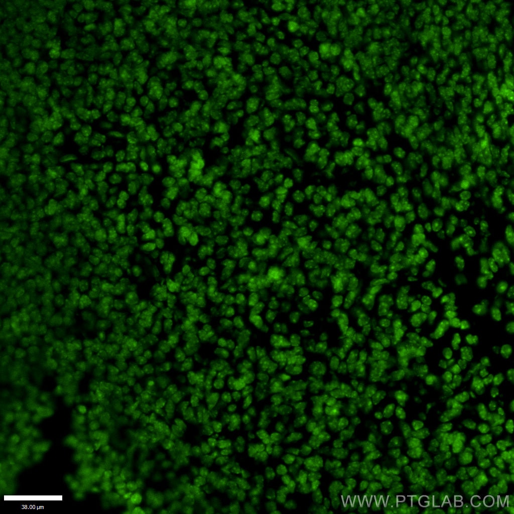 Immunofluorescence (IF) / fluorescent staining of mouse embryo tissue using OTX2 Polyclonal antibody (13497-1-AP)