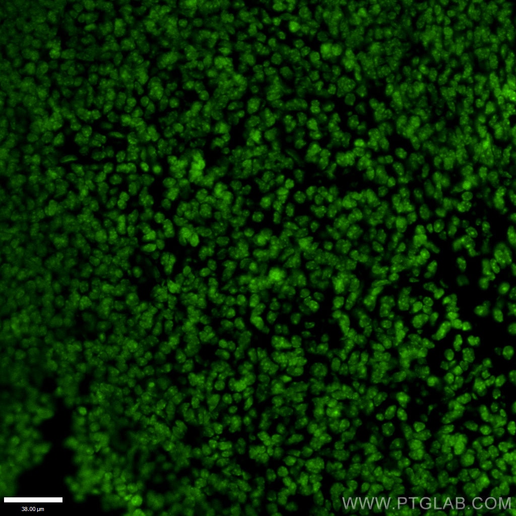 OTX2 Polyclonal antibody