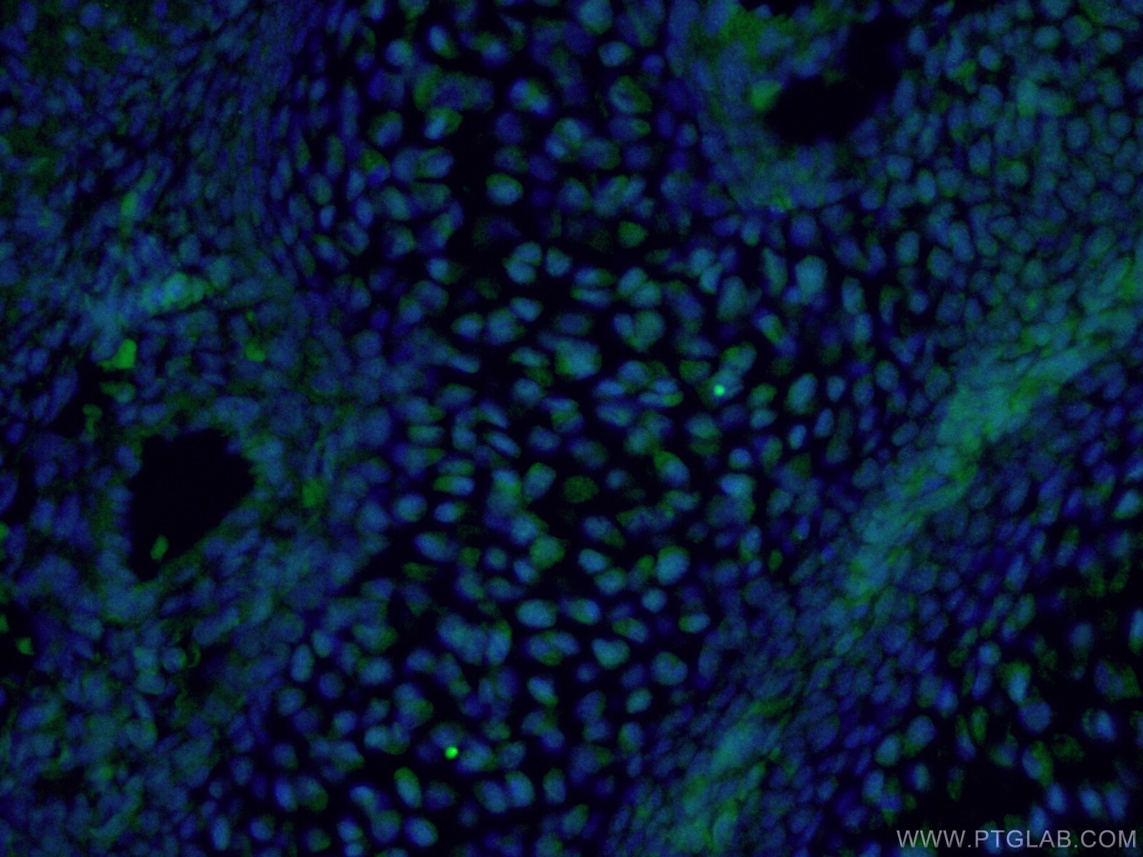 Immunofluorescence (IF) / fluorescent staining of mouse embryo tissue using OTX2 Polyclonal antibody (13497-1-AP)