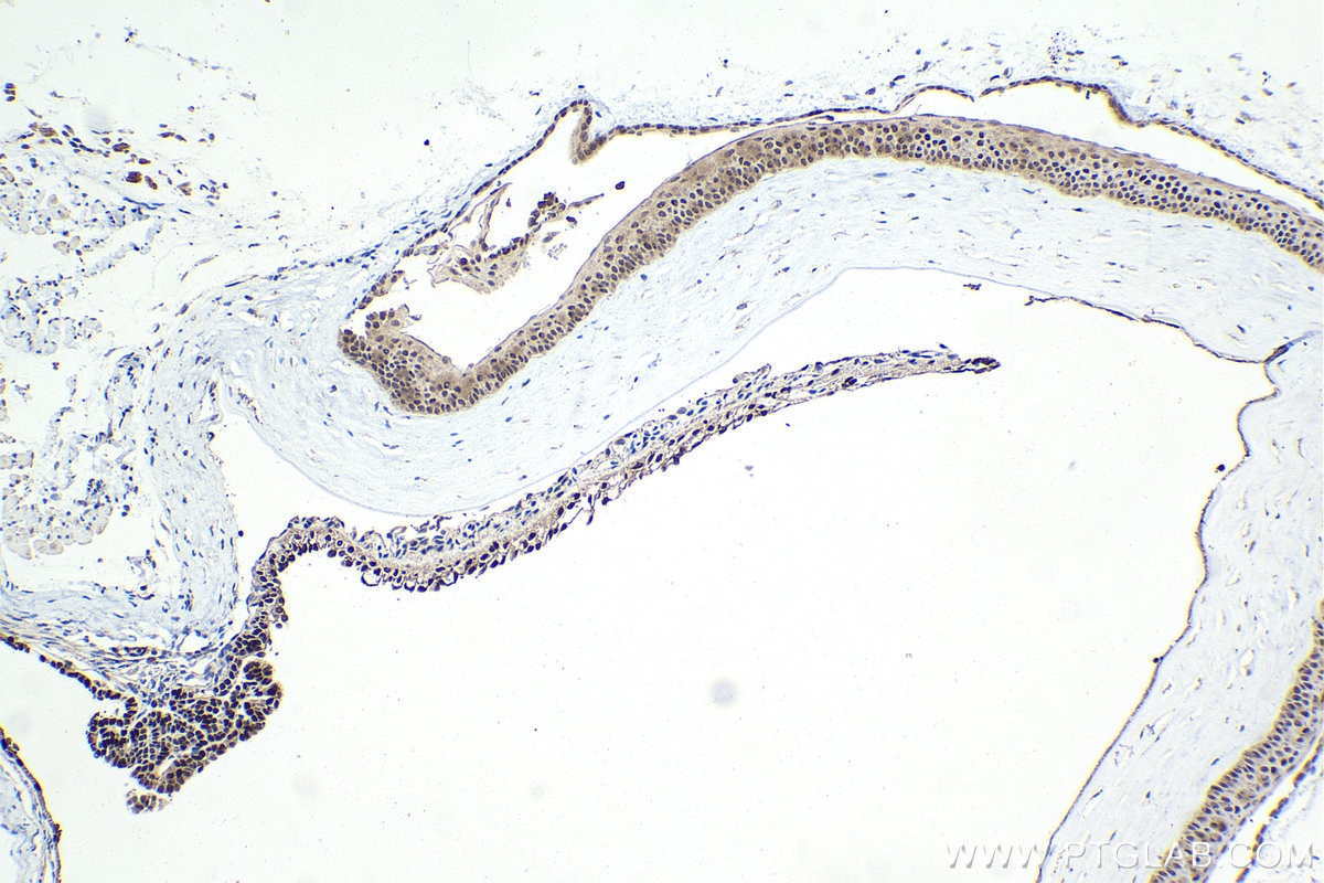 Immunohistochemical analysis of paraffin-embedded mouse eye tissue slide using 13497-1-AP (OTX2 antibody) at dilution of 1:2000 (under 10x lens). Heat mediated antigen retrieval with Tris-EDTA buffer (pH 9.0). Immunohistochemistry (IHC) staining of mouse eye tissue using OTX2 Polyclonal antibody (13497-1-AP)