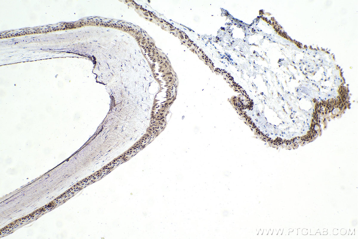 Immunohistochemical analysis of paraffin-embedded rat eye tissue slide using 13497-1-AP (OTX2 antibody) at dilution of 1:2000 (under 10x lens). Heat mediated antigen retrieval with Tris-EDTA buffer (pH 9.0). Immunohistochemistry (IHC) staining of rat eye tissue using OTX2 Polyclonal antibody (13497-1-AP)