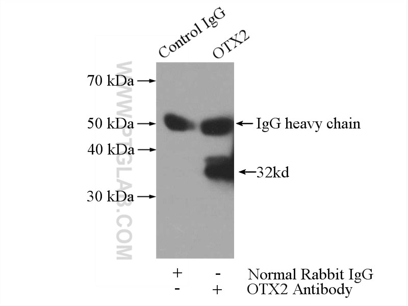 Immunoprecipitation (IP) experiment of Y79 cells using OTX2 Polyclonal antibody (13497-1-AP)