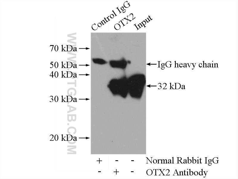 Immunoprecipitation (IP) experiment of Y79 cells using OTX2 Polyclonal antibody (13497-1-AP)