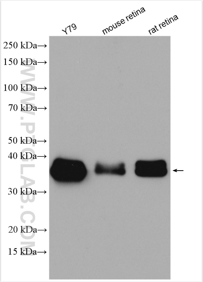 Western Blot (WB) analysis of various lysates using OTX2 Polyclonal antibody (13497-1-AP)