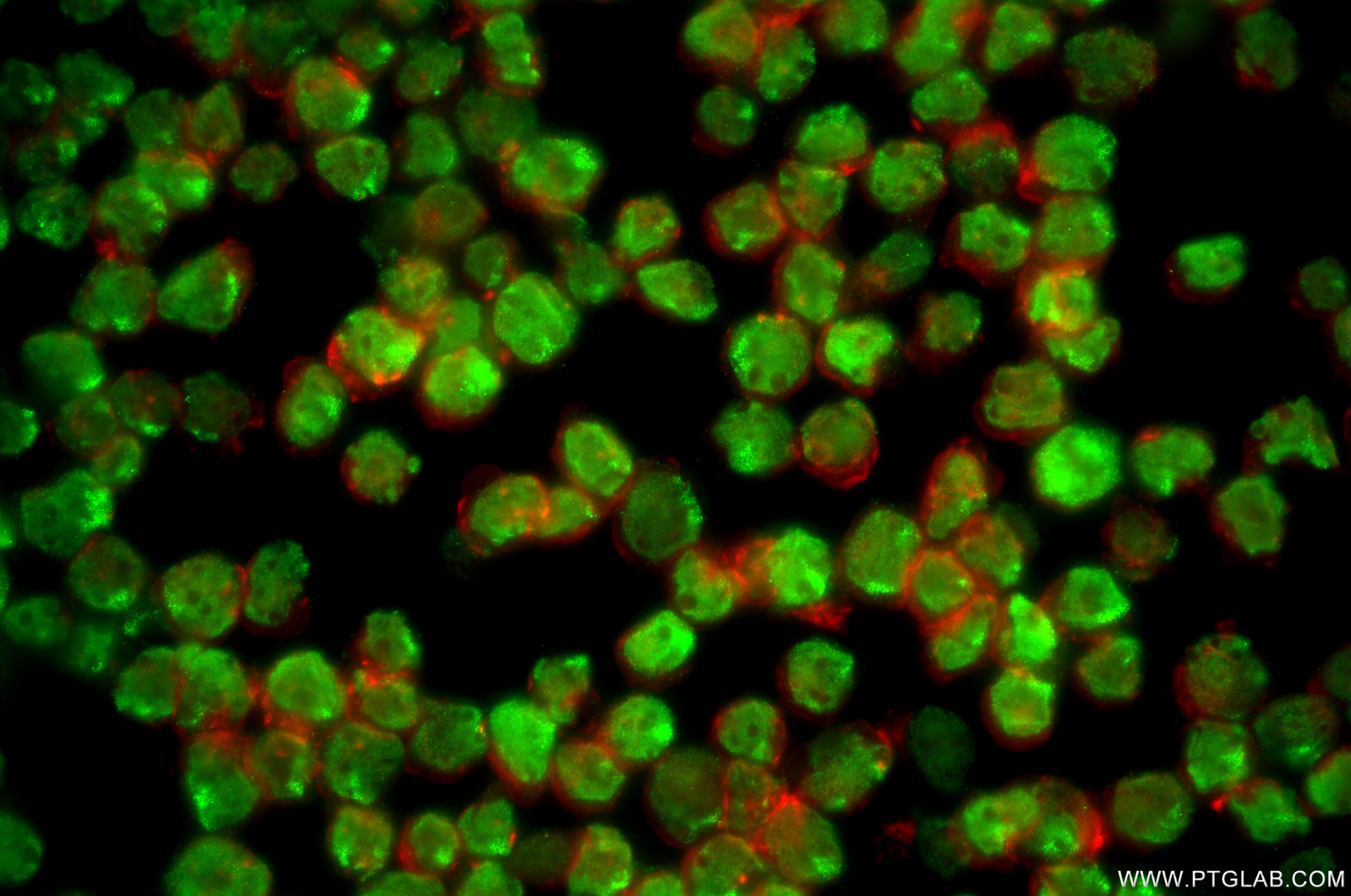 IF Staining of Y79 using 87372-1-RR Immunofluorescence (IF) / fluorescent staining of Y79 cells using OTX2 Recombinant monoclonal antibody (87372-1-RR)