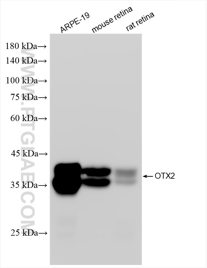 WB analysis using 87372-1-RR Western Blot (WB) analysis of various lysates using OTX2 Recombinant monoclonal antibody (87372-1-RR)