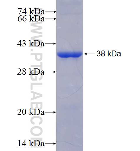 OTX2 fusion protein Ag4597 SDS-PAGE