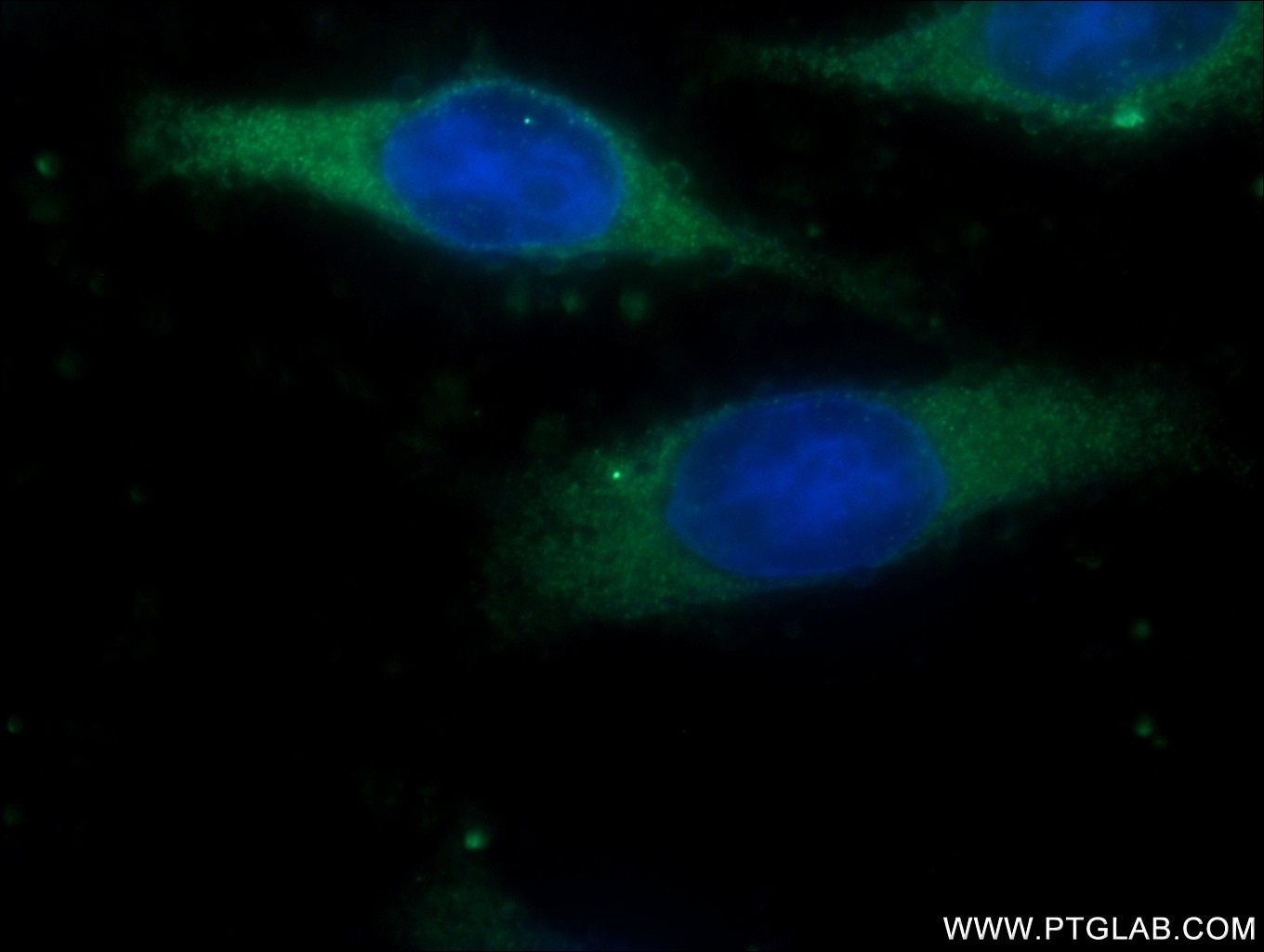 Immunofluorescence (IF) / fluorescent staining of HeLa cells using OVCA1 Polyclonal antibody (20112-1-AP)