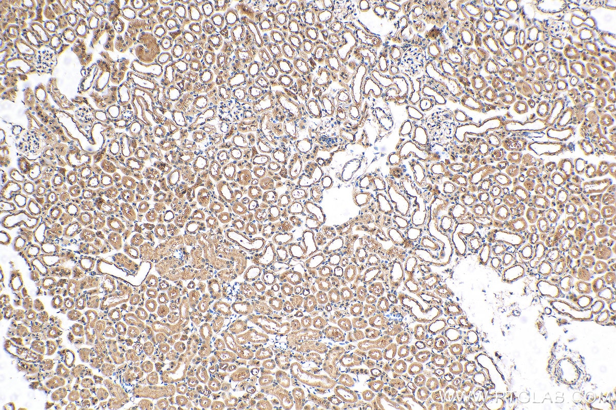 Immunohistochemistry (IHC) staining of mouse kidney tissue using OVCA2 Polyclonal antibody (14943-1-AP)