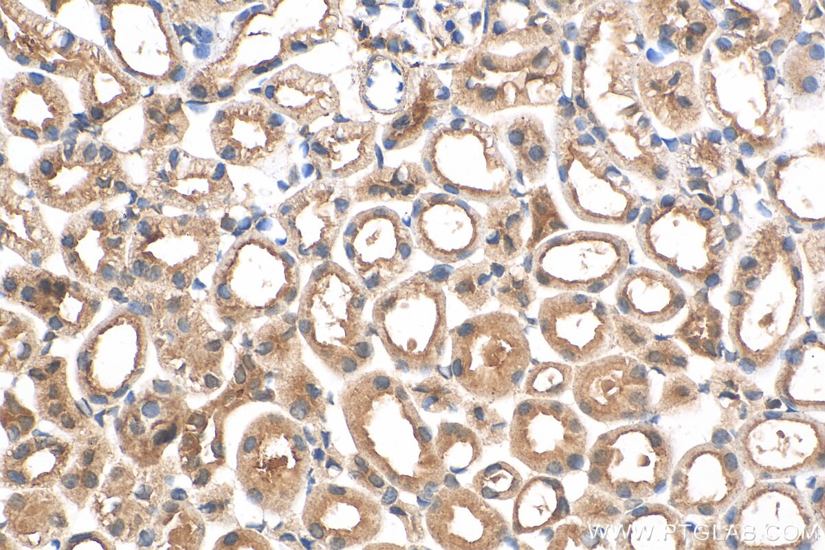 Immunohistochemistry (IHC) staining of mouse kidney tissue using OVCA2 Polyclonal antibody (14943-1-AP)