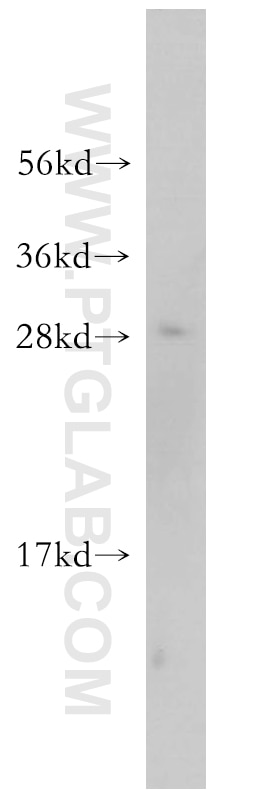 Western Blot (WB) analysis of human brain tissue using OVCA2 Polyclonal antibody (14943-1-AP)