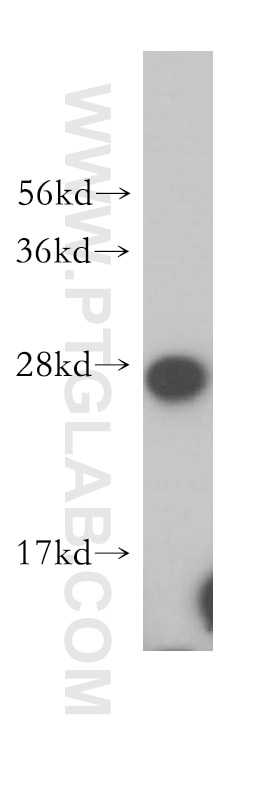 Western Blot (WB) analysis of human kidney tissue using OVCA2 Polyclonal antibody (14943-1-AP)