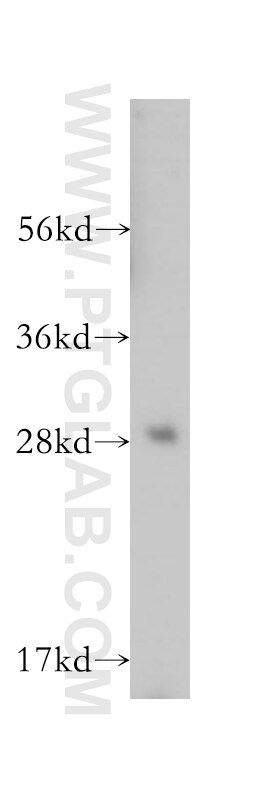 Western Blot (WB) analysis of mouse thymus tissue using OVCA2 Polyclonal antibody (14943-1-AP)