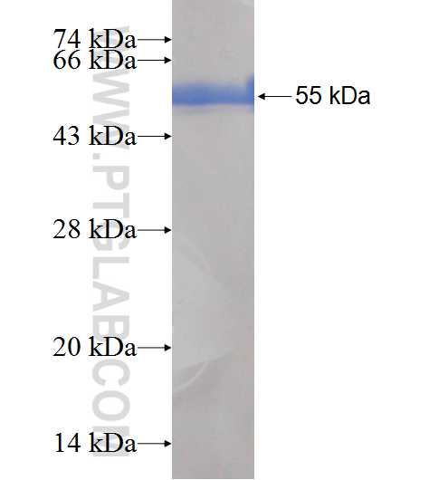 OVCA2 fusion protein Ag6744 SDS-PAGE