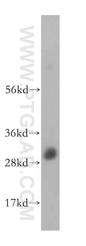 Western Blot (WB) analysis of human brain tissue using OVOL1 Polyclonal antibody (14082-1-AP)