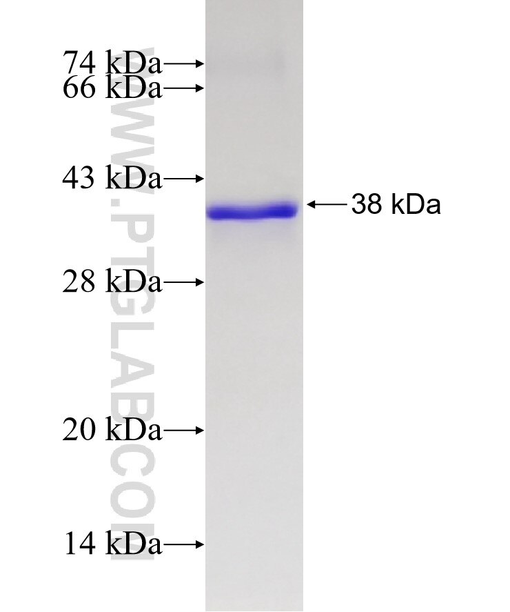 OVOL1 fusion protein Ag5198 SDS-PAGE