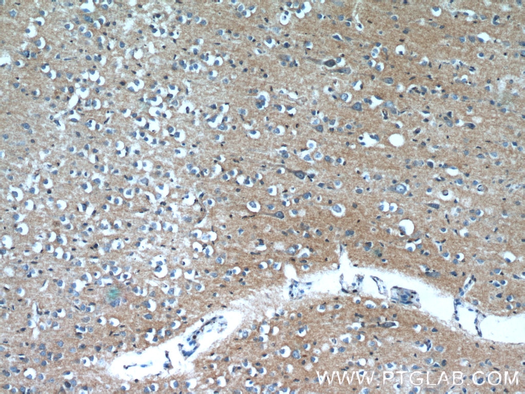 Immunohistochemistry (IHC) staining of human brain tissue using OXA1L Monoclonal antibody (66128-1-Ig)
