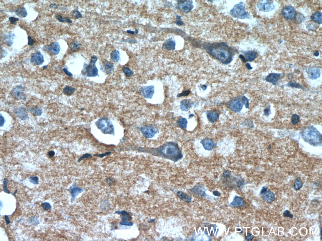 Immunohistochemistry (IHC) staining of human brain tissue using OXA1L Monoclonal antibody (66128-1-Ig)