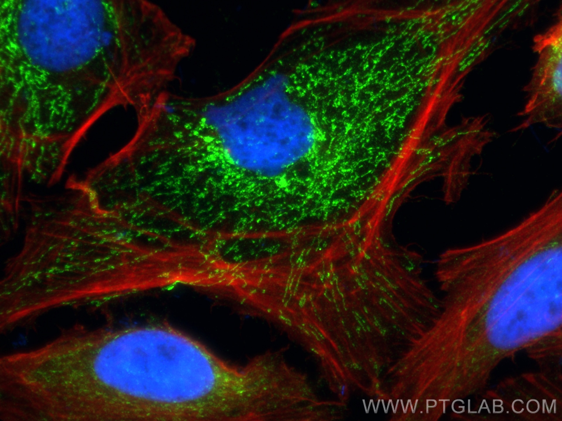 Immunofluorescence (IF) / fluorescent staining of HeLa cells using OXCT1 Monoclonal antibody (67836-1-Ig)