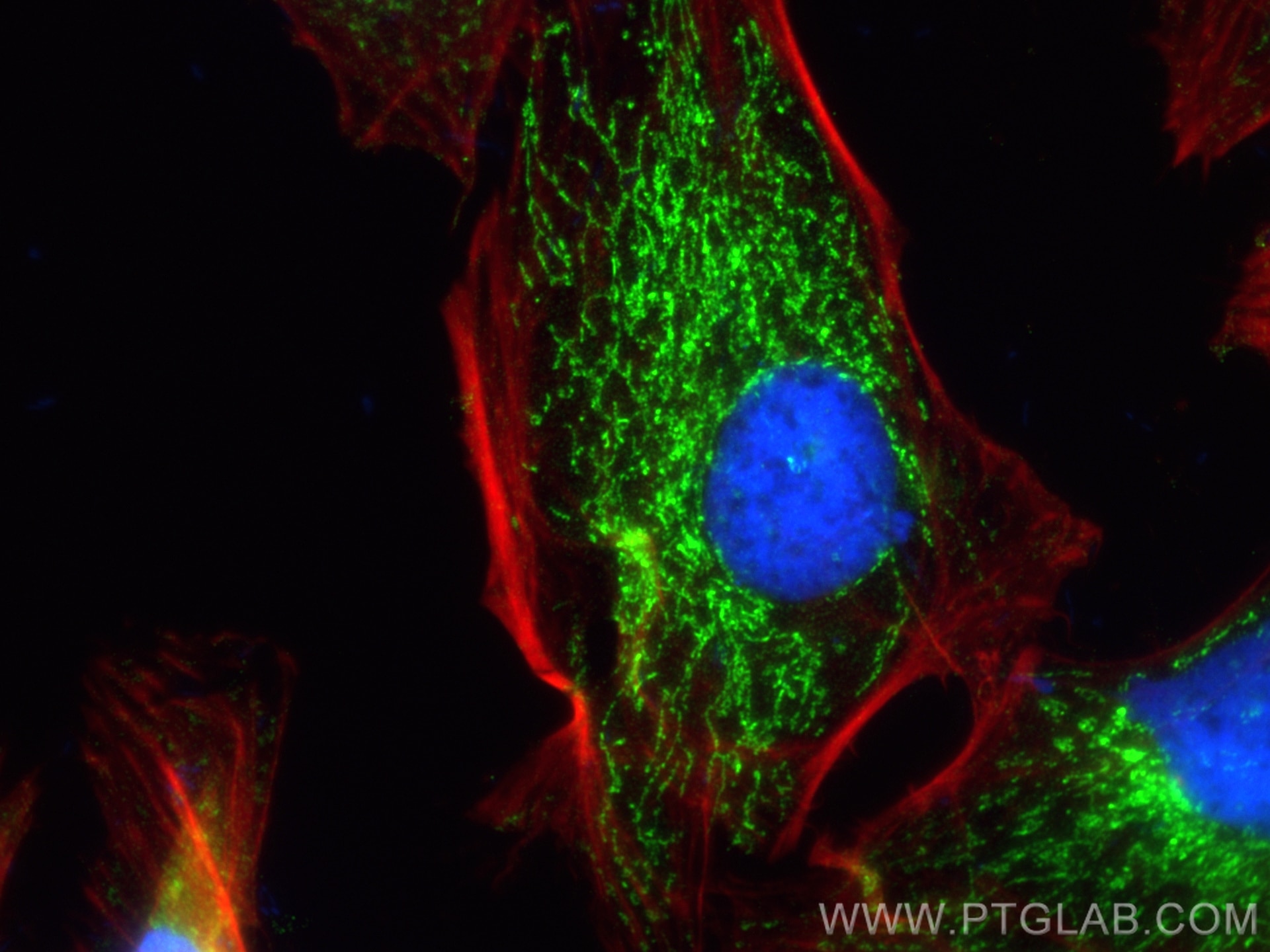 Immunofluorescence (IF) / fluorescent staining of HeLa cells using OXCT1 Monoclonal antibody (67836-1-Ig)