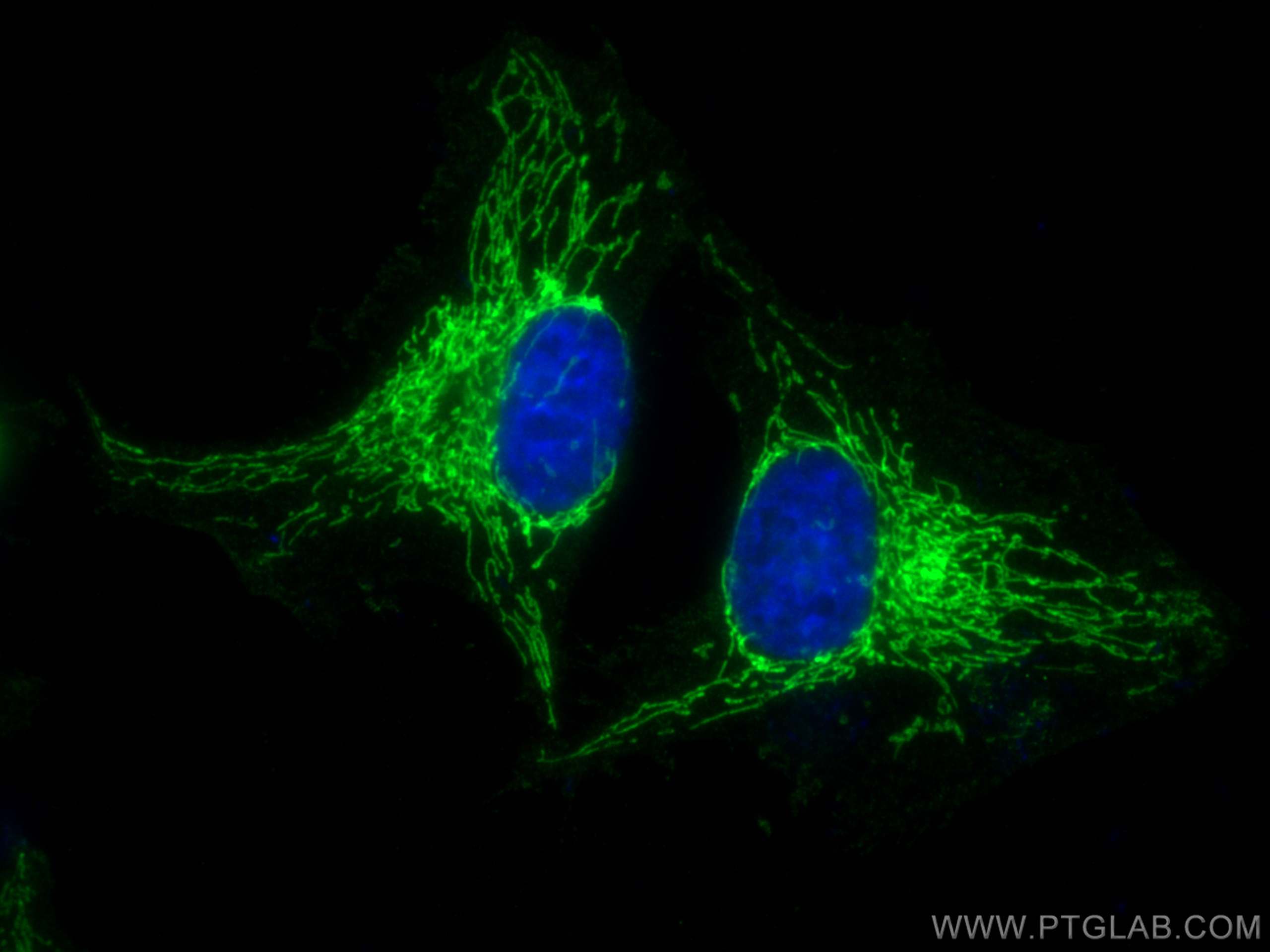 Immunofluorescence (IF) / fluorescent staining of HeLa cells using OXCT1 Monoclonal antibody (67836-1-Ig)