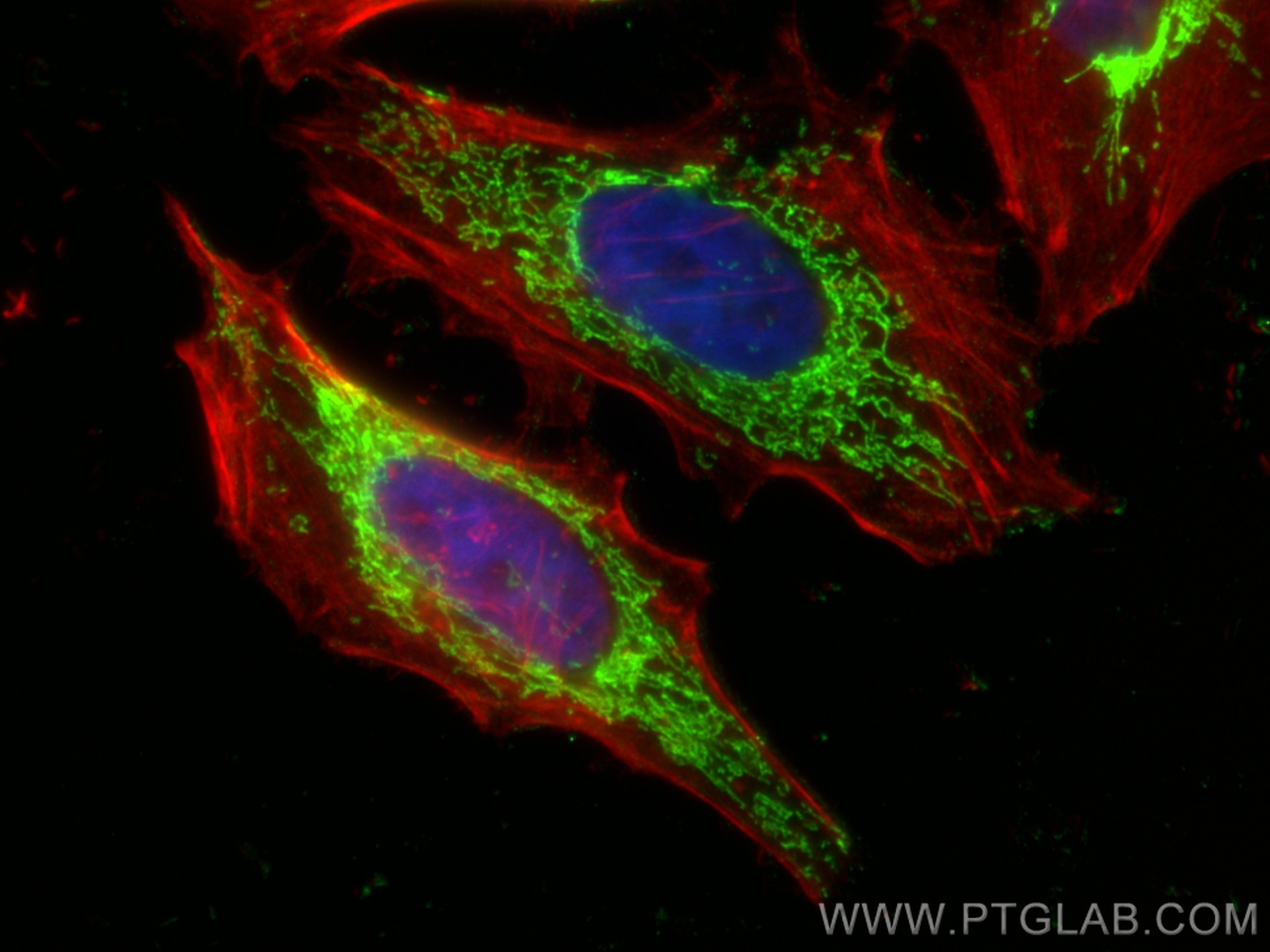 Immunofluorescence (IF) / fluorescent staining of HeLa cells using OXCT1 Monoclonal antibody (67836-1-Ig)