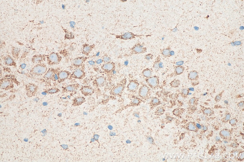 Immunohistochemistry (IHC) staining of rat brain tissue using OXCT1 Monoclonal antibody (67836-1-Ig)