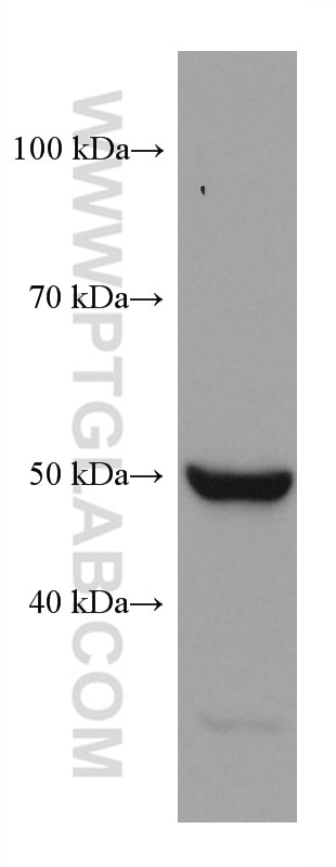 Western Blot (WB) analysis of HeLa cells using OXCT1 Monoclonal antibody (67836-1-Ig)